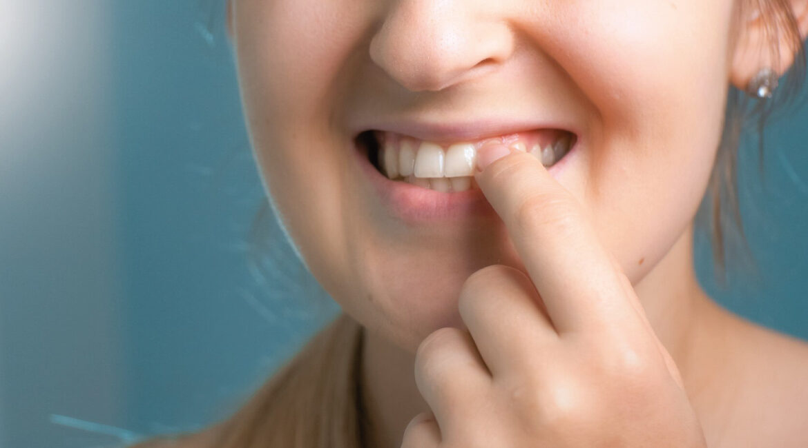 ¿Estás cuidando tus encías tanto como tus dientes?