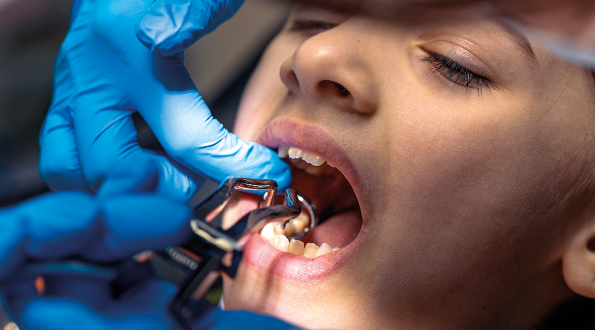 Cuidados esenciales después de una extracción