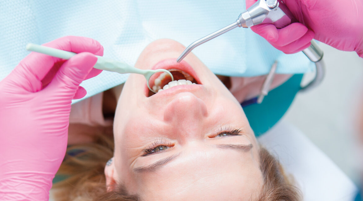 Cuidados después de una limpieza dental profunda