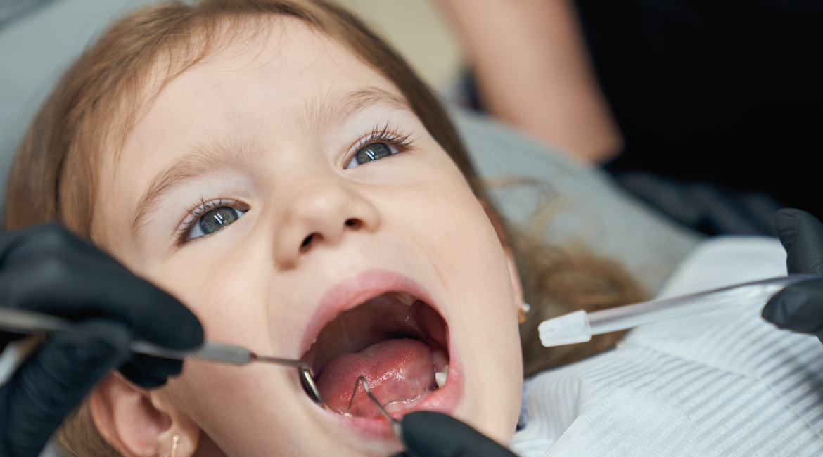 Caries en niños: señales de alerta que no debes ignorar