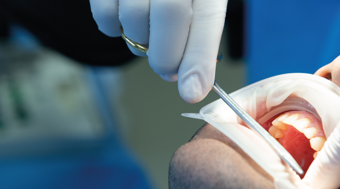 Dolor dental: cómo saber si necesitas una endodoncia